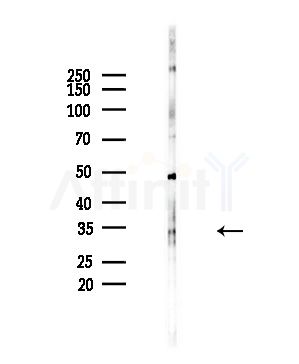 Stanniocalcin 2 Antibody - Western blot analysis of lysates from PC12 cells(starvation,24h treatment), using Stanniocalcin 2 Antibody at 1/1000 dilution.