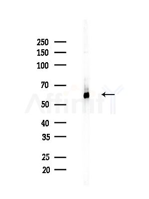 STAU1 Antibody - Western blot analysis of lysates from B16F10-LUC cells(LPS,4h treatment), using STAU1 Antibody at 1/1000 dilution.