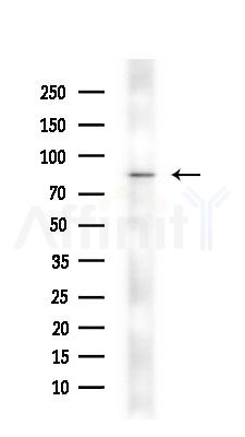 STT3B Antibody - Western blot analysis of extracts from Mouse liver, using STT3B Antibody at 1/1000 dilution.