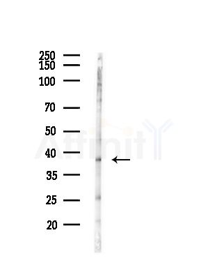 SULT1C2 Antibody - Western blot analysis of lysates from A375 cells(heat-shock, 45min treatment), using SULT1C2 Antibody at 1/1000 dilution.
