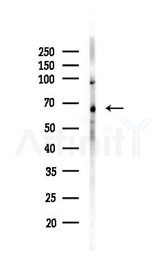 Syndecan-3 Antibody - Western blot analysis of lysates from MCF7 cells(heat-shock,45min treatment), using Syndecan-3 Antibody at 1/1000 dilution.