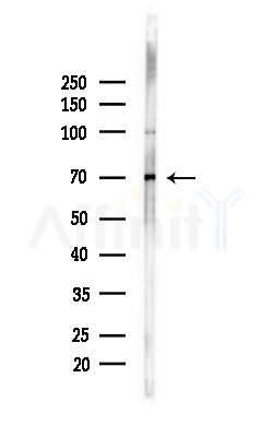 Syndecan-3 Antibody - Western blot analysis of lysates from Mouse brain, using Syndecan-3 Antibody at 1/1000 dilution.