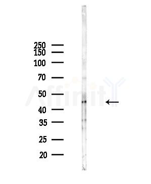 UQCRC2 Antibody - Western blot analysis of lysates from Hela cells(heat-shock,45min treatment), using UQCRC2 Antibody at 1/1000 dilution.
