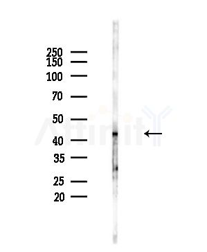 UQCRC2 Antibody - Western blot analysis of lysates from PC12 cells(starvation,24h treatment), using UQCRC2 Antibody at 1/1000 dilution.