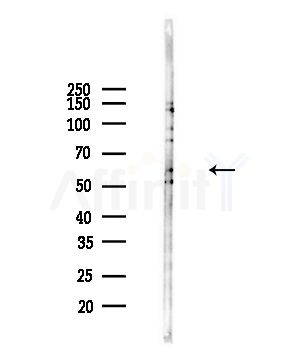 URAT1 Antibody - Western blot analysis of lysates from Hela cells(heat-shock,45min treatment), using URAT1 Antibody at 1/1000 dilution.