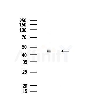 URAT1 Antibody - Western blot analysis of lysates from Rat liver, using URAT1 Antibody at 1/1000 dilution.