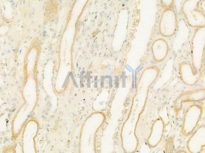 URAT1 Antibody - DF12340 at 1/100 staining human normal kidney tissue by IHC-P.
