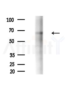 WDR46 Antibody - Western blot analysis of extracts from B16F10-LUC cells(heat-shock,45min treatment), using WDR46 Antibody at 1/1000 dilution.