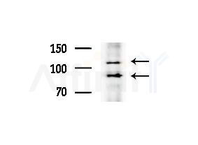 ZC3HAV1 Antibody - Western blot analysis of extracts from COLO205 cells(heat-shock treatment), using ZC3HAV1 Antibody at 1/1000 dilution.