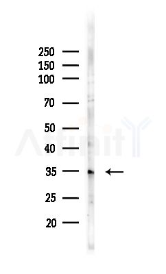 ZnT3 Antibody - Western blot analysis of lysates from MCF7 cells(heat-shock,45min treatment), using ZnT3 Antibody at 1/1000 dilution.