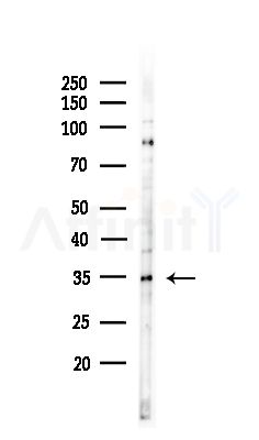 ZnT3 Antibody - Western blot analysis of lysates from COLO205 cells(UV,30min treatment), using ZnT3 Antibody at 1/1000 dilution.