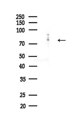 Aconitase 2 Antibody - Western blot analysis of lysates from Hela cells(heat-shock,45min treatment), using Aconitase 2 Antibody at 1/1000 dilution.
