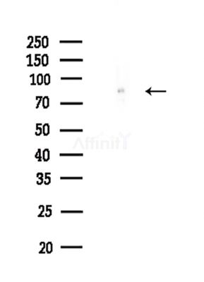 Aconitase 2 Antibody - Western blot analysis of lysates from Rat brain, using Aconitase 2 Antibody at 1/1000 dilution.