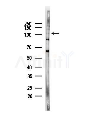 alpha Adaptin Antibody - Western blot analysis of lysates from COLO205 cells(heat-shock,45min treatment), using alpha Adaptin Antibody at 1/1000 dilution.