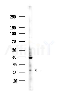 ARHGDIB Antibody - Western blot analysis of lysates from COLO205 cells(heat-shock,45min treatment), using ARHGDIB Antibody at 1/1000 dilution.