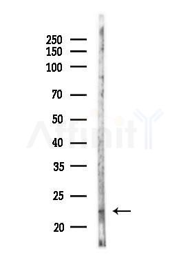 ARL8B Antibody - Western blot analysis of lysates from COLO205 cells(UV,30min treatment), using ARL8B Antibody at 1/1000 dilution.
