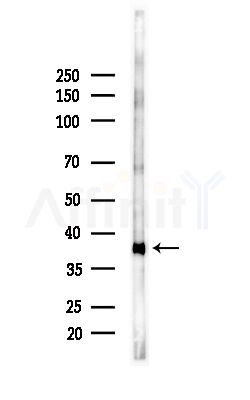 ASBT Antibody - Western blot analysis of lysates from Mouse brain, using ASBT Antibody at 1/1000 dilution.