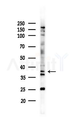 ASBT Antibody - Western blot analysis of lysates from MCF7 cells(heat-shock,45min treatment), using ASBT Antibody at 1/1000 dilution.