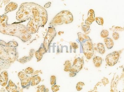 ATP8A1 Antibody - DF12354 at 1/100 staining human normal placenta tissue by IHC-P.