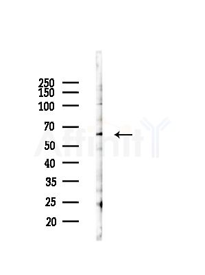 BAMBI Antibody - Western blot analysis of lysates from Hela cells(starvation,24h treatment), using BAMBI Antibody at 1/1000 dilution.