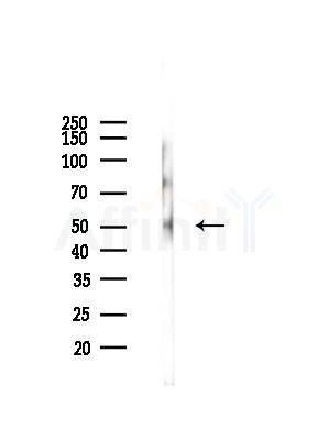 BBS4 Antibody - Western blot analysis of lysates from Mouse brain, using BBS4 Antibody at 1/1000 dilution.