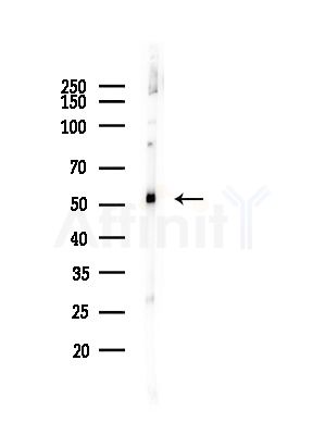 CALCOCO2 Antibody - Western blot analysis of lysates from A375 cells(heat-shock, 45min treatment), using CALCOCO2 Antibody at 1/1000 dilution.