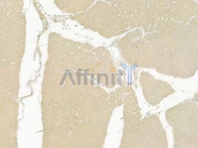 CALCOCO2 Antibody - DF12360 at 1/100 staining human normal gastric tissue by IHC-P.