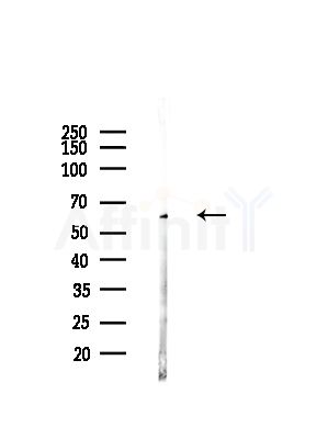 CCBL1/KAT1 Antibody - Western blot analysis of lysates from Hela cells(starvation,24h treatment), using CCBL1/KAT1 Antibody at 1/1000 dilution.