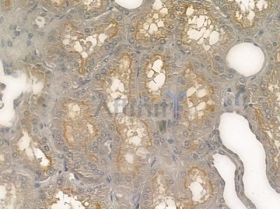 CFHR3 Antibody - DF12363 at 1/100 staining human normal kidney tissue by IHC-P.