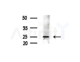 CHCHD4 Antibody - Western blot analysis of extracts from Mouse liver, using CHCHD4 Antibody at 1/1000 dilution.