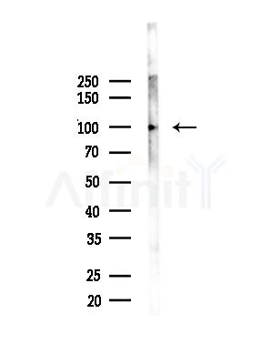 CIN85 Antibody - Western blot analysis of lysates from Mouse liver, using CIN85 Antibody at 1/1000 dilution.