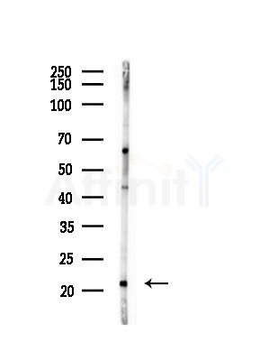 CNPY2/MSAP Antibody - Western blot analysis of lysates from A375 cells(heat-shock, 45min treatment), using CNPY2/MSAP Antibody at 1/1000 dilution.