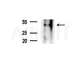 COQ9 Antibody - Western blot analysis of extracts from COLO205 cells(heat-shock treatment), using COQ9 Antibody at 1/1000 dilution.