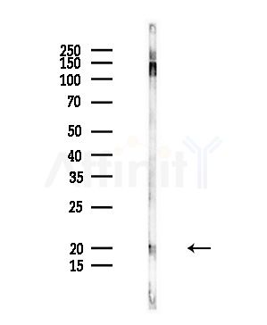 CPLX2 Antibody - Western blot analysis of lysates from Rat liver, using CPLX2 Antibody at 1/1000 dilution.