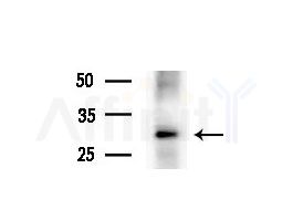 CTHRC1 Antibody - Western blot analysis of extracts from HepG2 cells(heat-shock treatment), using CTHRC1 Antibody at 1/1000 dilution.