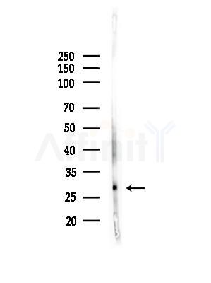 CTHRC1 Antibody - Western blot analysis of lysates from HepG2 cells(heat-shock,45min treatment), using CTHRC1 Antibody at 1/1000 dilution.