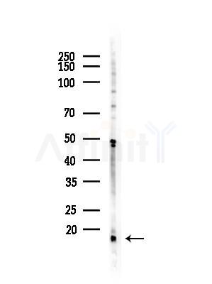 CXCL14 Antibody - Western blot analysis of lysates from COLO205 cells(heat-shock,45min treatment), using CXCL14 Antibody at 1/1000 dilution.