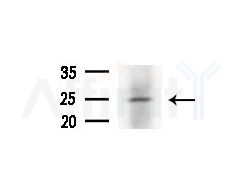 CYPC Antibody - Western blot analysis of extracts from COLO205 cells(heat-shock treatment), using CYPC Antibody at 1/1000 dilution.