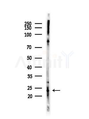 CYPC Antibody - Western blot analysis of lysates from COLO205 cells(heat-shock,45min treatment), using CYPC Antibody at 1/1000 dilution.