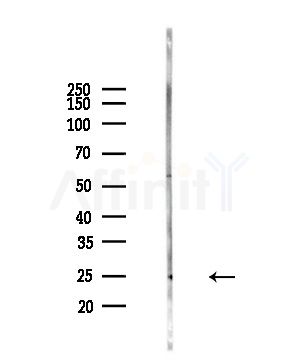 DCTN6 Antibody - Western blot analysis of lysates from Hela cells(heat-shock,45min treatment), using DCTN6 Antibody at 1/1000 dilution.