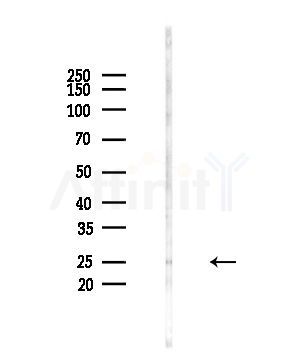 DCTN6 Antibody - Western blot analysis of lysates from PC12 cells(starvation,24h treatment), using DCTN6 Antibody at 1/1000 dilution.