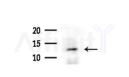 DNAJC19 Antibody - Western blot analysis of extracts from COLO205 cells(heat-shock treatment), using DNAJC19 Antibody at 1/1000 dilution.