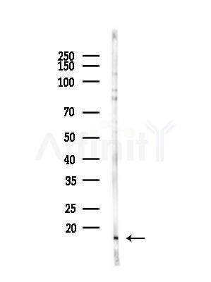 DNAJC19 Antibody - Western blot analysis of lysates from COLO205 cells(heat-shock,45min treatment), using DNAJC19 Antibody at 1/1000 dilution.