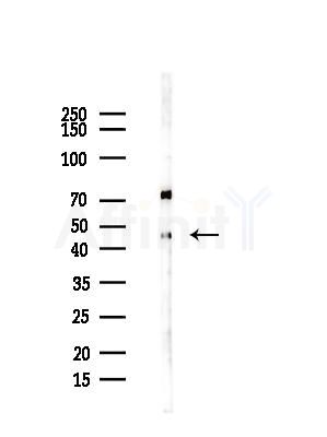 DOM3Z Antibody - Western blot analysis of lysates from COLO205 cells(UV,30min treatment), using DOM3Z Antibody at 1/1000 dilution.