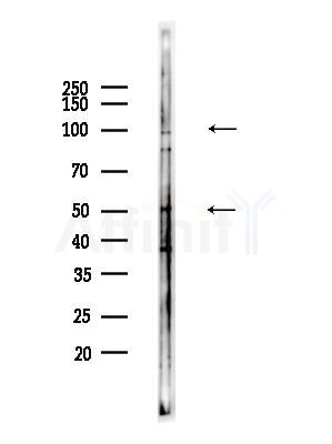CD26 Antibody - Western blot analysis of lysates from HepG2 cells(heat-shock,45min treatment), using CD26 Antibody at 1/1000 dilution.