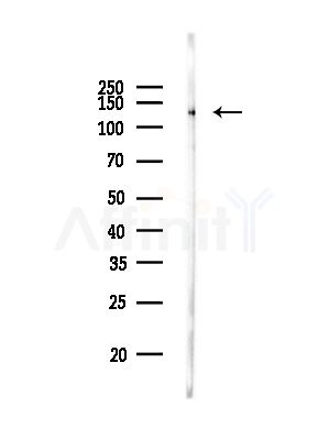 Drebrin Antibody - Western blot analysis of lysates from Rat brain, using Drebrin Antibody at 1/1000 dilution.