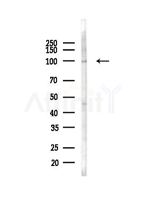 Drebrin Antibody - Western blot analysis of lysates from COLO205 cells(heat-shock,45min treatment), using Drebrin Antibody at 1/1000 dilution.