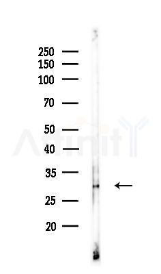EIF2B1 Antibody - Western blot analysis of lysates from COLO205 cells(UV,30min treatment), using EIF2B1 Antibody at 1/1000 dilution.