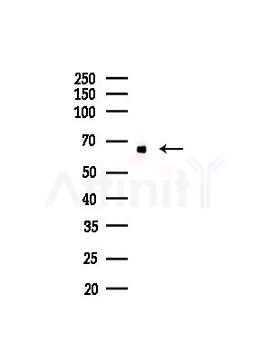 ETFDH Antibody - Western blot analysis of lysates from COLO205 cells(UV,30min treatment), using ETFDH Antibody at 1/1000 dilution.