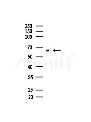 ETFDH Antibody - Western blot analysis of lysates from Mouse brain, using ETFDH Antibody at 1/1000 dilution.